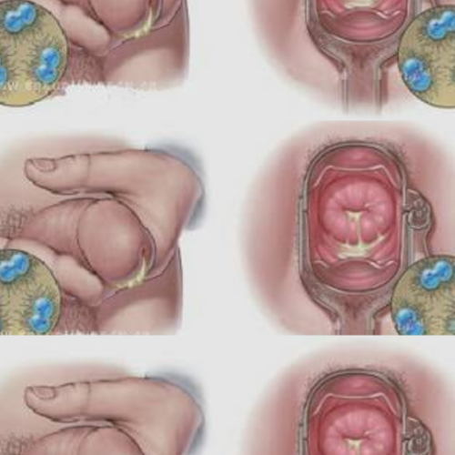 1001522496 2